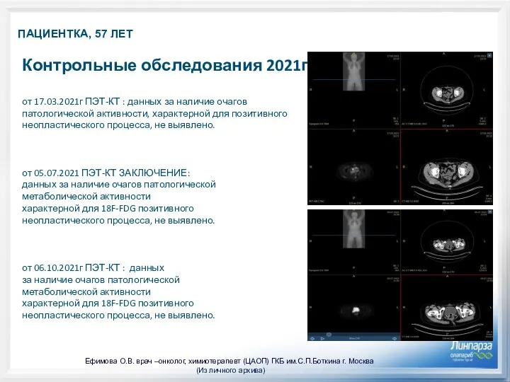 ПАЦИЕНТКА, 57 ЛЕТ Контрольные обследования 2021год: от 17.03.2021г ПЭТ-КТ : данных за