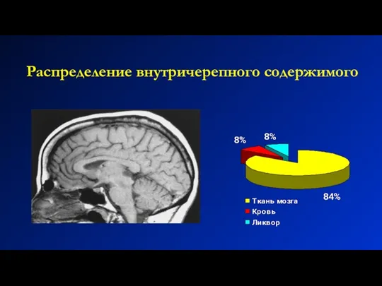 Распределение внутричерепного содержимого