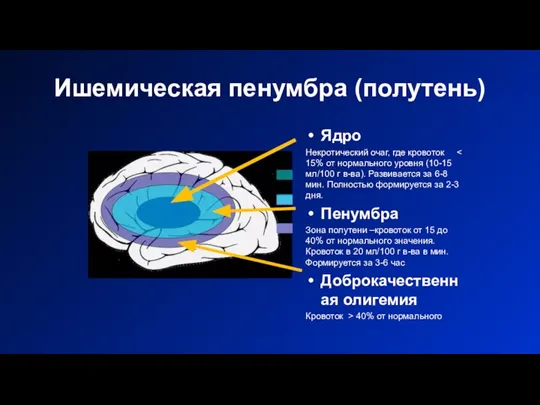 Ишемическая пенумбра (полутень) Ядро Некротический очаг, где кровоток Пенумбра Зона полутени –кровоток