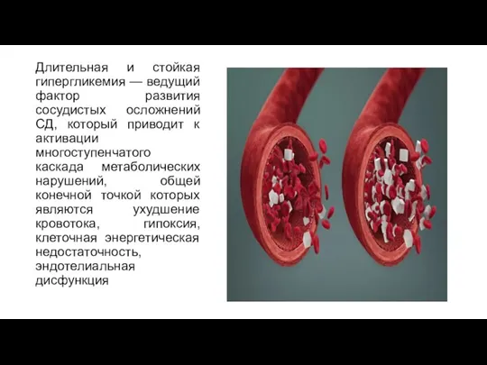 Длительная и стойкая гипергликемия — ведущий фактор развития сосудистых осложнений СД, который