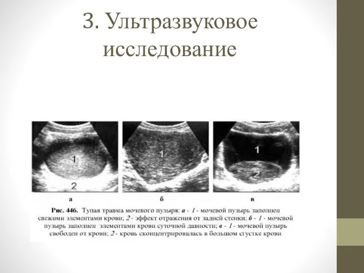 3. Ультразвуковое исследование