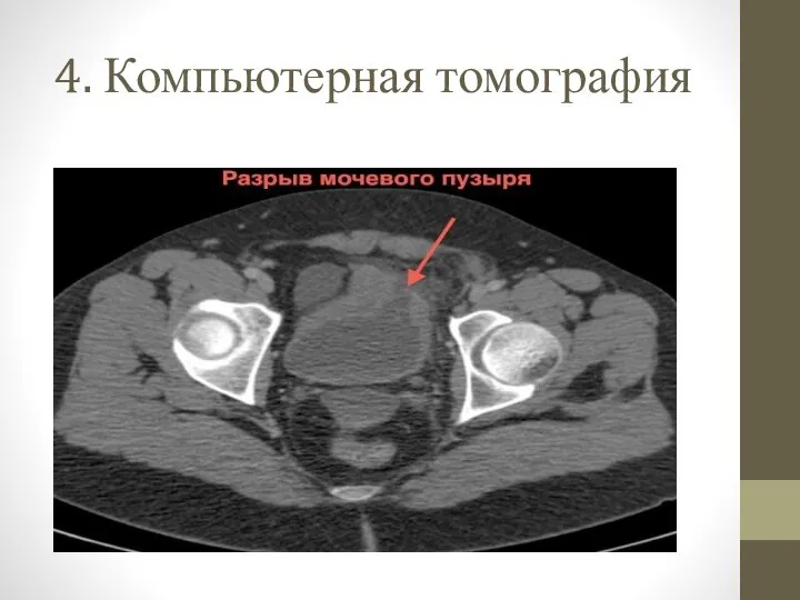 4. Компьютерная томография