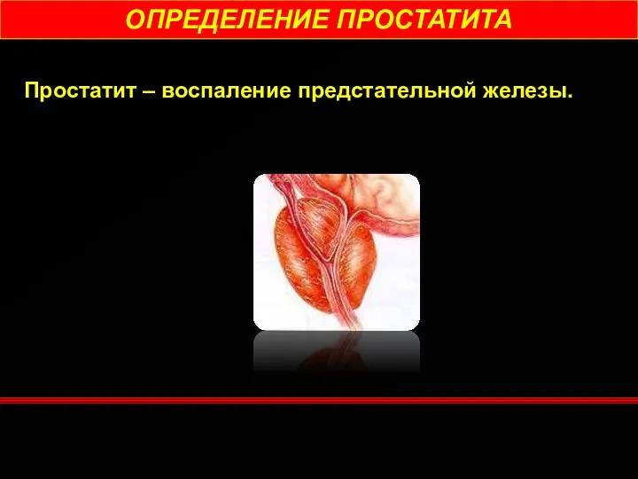 ОПРЕДЕЛЕНИЕ ПРОСТАТИТА Простатит – воспаление предстательной железы.