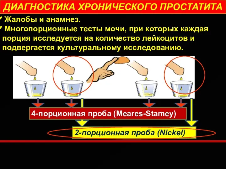 Жалобы и анамнез. Многопорционные тесты мочи, при которых каждая порция исследуется на