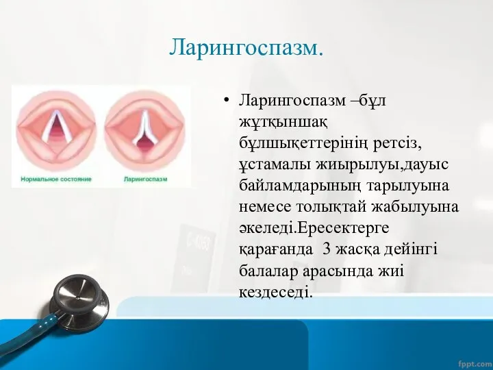 Ларингоспазм. Ларингоспазм –бұл жұтқыншақ бұлшықеттерінің ретсіз,ұстамалы жиырылуы,дауыс байламдарының тарылуына немесе толықтай жабылуына