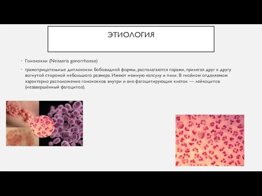 ЭТИОЛОГИЯ Гонококки (Neisseria gonorrhoeae) грамотрицательные диплококки бобовидной формы, располагаются парами, прилегая друг