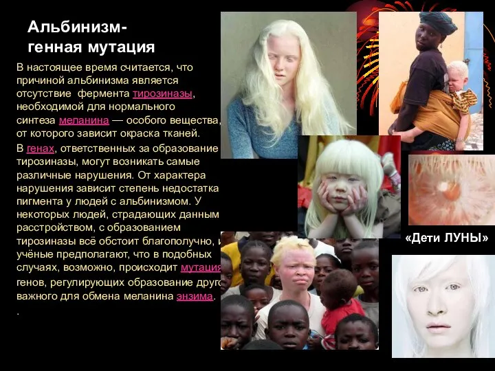 Альбинизм- генная мутация В настоящее время считается, что причиной альбинизма является отсутствие