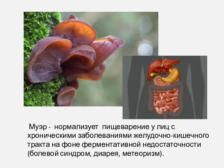 Муэр - нормализует пищеварение у лиц с хроническими заболеваниями желудочно-кишечного тракта на