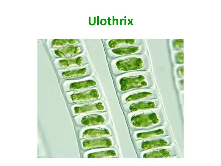 Ulothrix