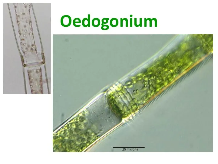 Oedogonium