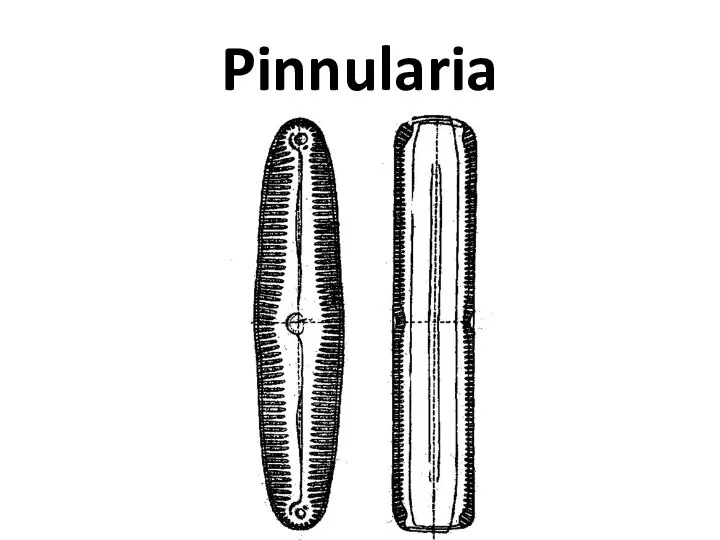 Pinnularia