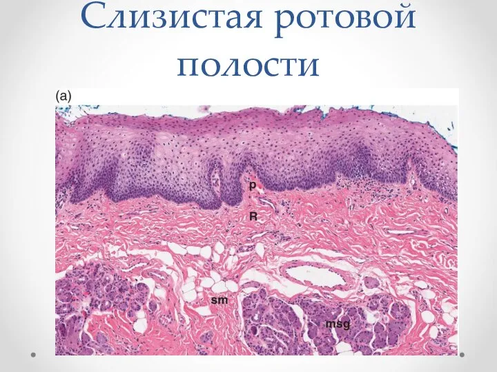 Слизистая ротовой полости