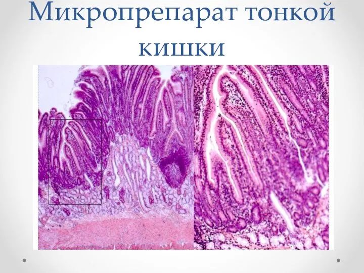 Микропрепарат тонкой кишки