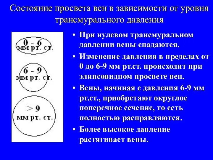 Состояние просвета вен в зависимости от уровня трансмурального давления При нулевом трансмуральном