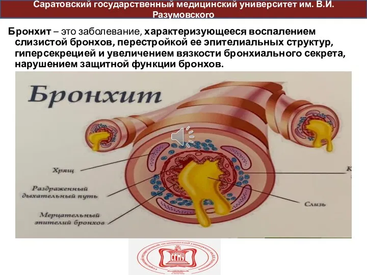 Бронхит – это заболевание, характеризующееся воспалением слизистой бронхов, перестройкой ее эпителиальных структур,