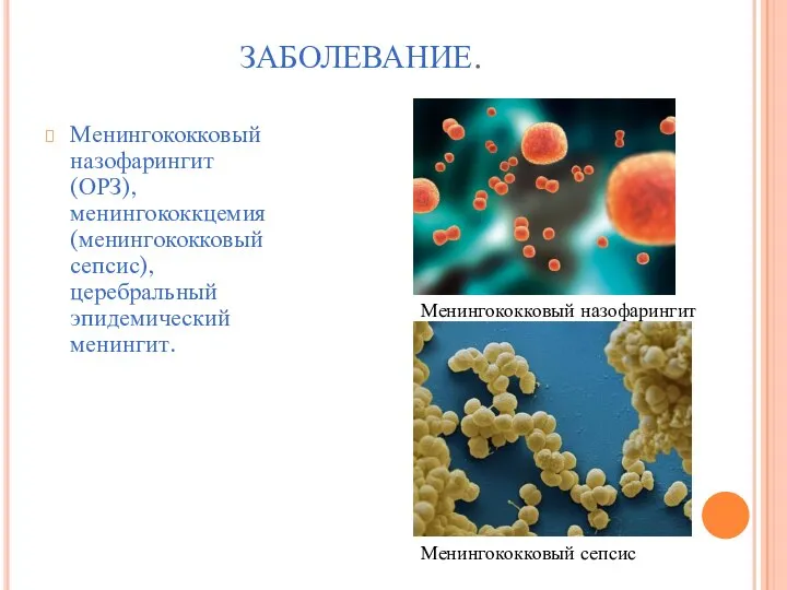 ЗАБОЛЕВАНИЕ. Менингококковый назофарингит(ОРЗ),менингококкцемия(менингококковый сепсис), церебральный эпидемический менингит. Менингококковый назофарингит Менингококковый сепсис