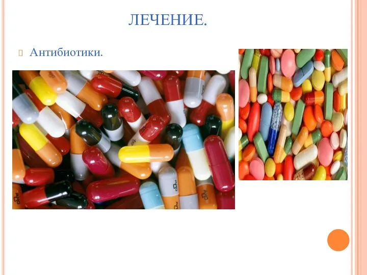 ЛЕЧЕНИЕ. Антибиотики.