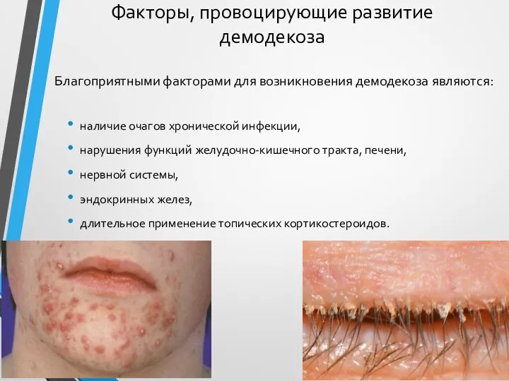 Факторы, провоцирующие развитие демодекоза Благоприятными факторами для возникновения демодекоза являются: наличие очагов