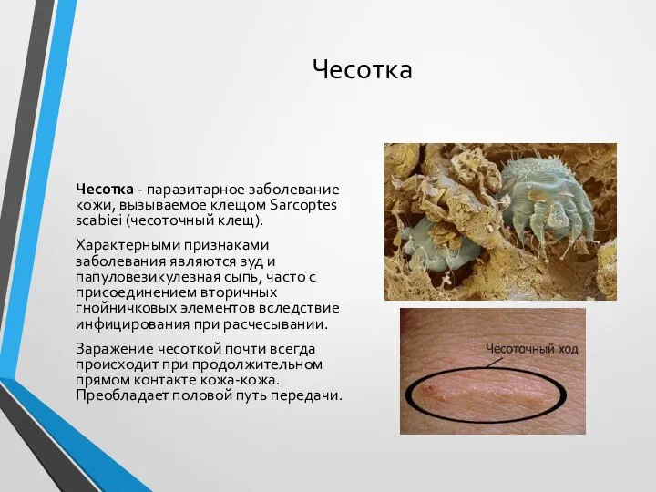 Чесотка Чесотка - паразитарное заболевание кожи, вызываемое клещом Sarcoptes scabiei (чесоточный клещ).
