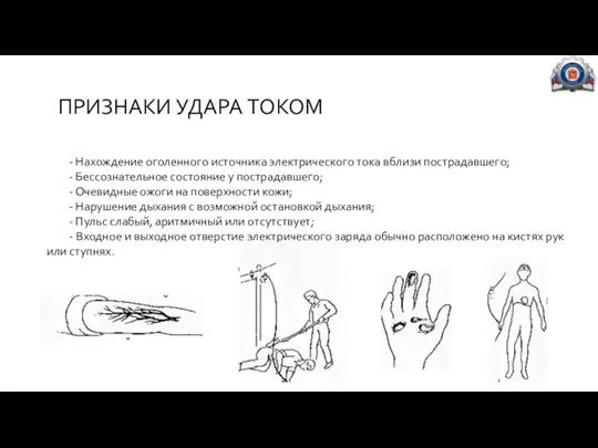 ПРИЗНАКИ УДАРА ТОКОМ - Нахождение оголенного источника электрического тока вблизи пострадавшего; -