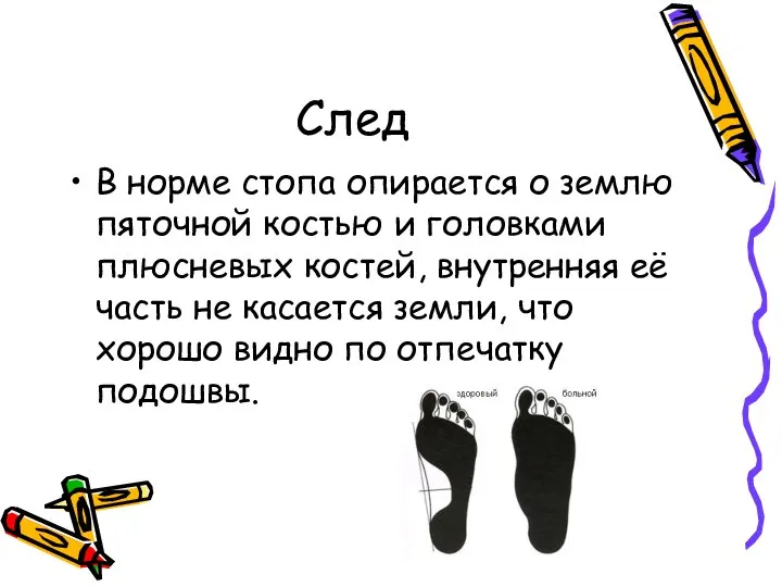 След В норме стопа опирается о землю пяточной костью и головками плюсневых