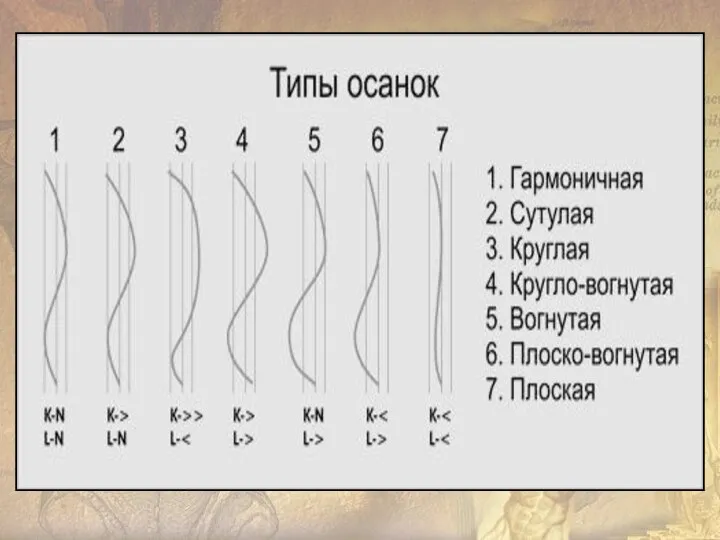 а- нормальная осанка; б- кифотическая осанка (круглая спина, сутулая спина); в- плоская