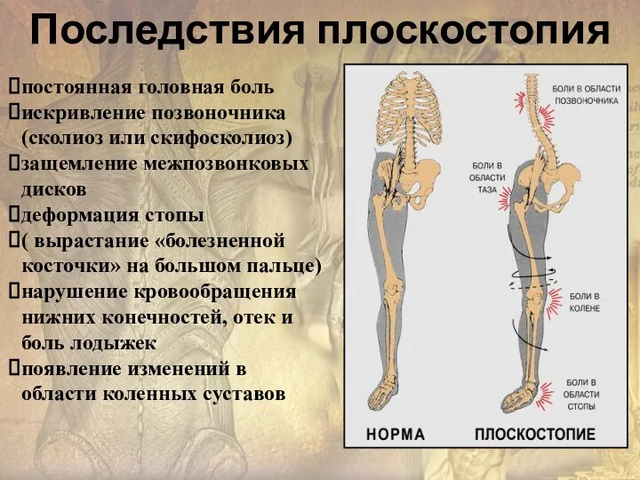 постоянная головная боль искривление позвоночника(сколиоз или скифосколиоз) защемление межпозвонковых дисков деформация стопы