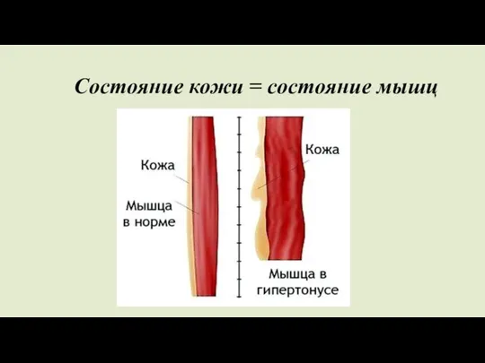 Состояние кожи = состояние мышц