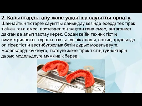 2. Қалыптарды алу және уақытша сауытты орнату. Шайнайтын тістерге сауытты дайындау кезінде