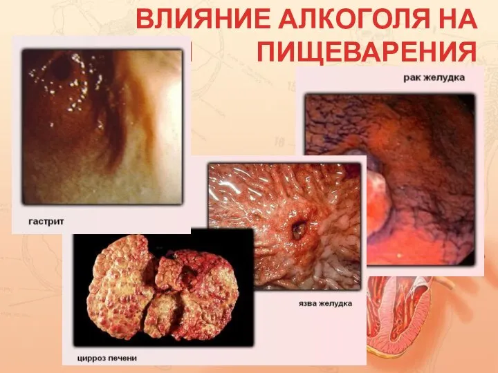 ВЛИЯНИЕ АЛКОГОЛЯ НА ОРГАНЫ ПИЩЕВАРЕНИЯ