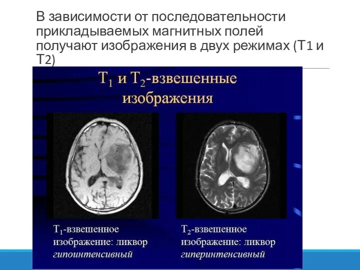 В зависимости от последовательности прикладываемых магнитных полей получают изображения в двух режимах (Т1 и Т2)