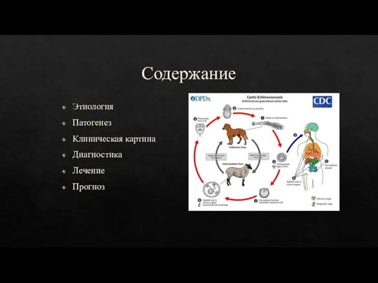 Содержание Этиология Патогенез Клиническая картина Диагностика Лечение Прогноз