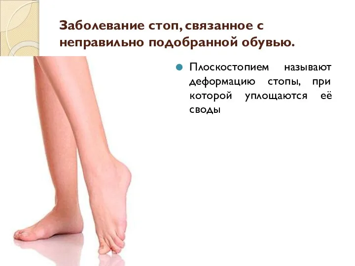 Заболевание стоп, связанное с неправильно подобранной обувью. Плоскостопием называют деформацию стопы, при которой уплощаются её своды