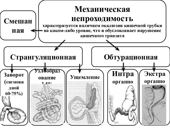 Механическая непроходимость характеризуется наличием окклюзии кишечной трубки на каком-либо уровне, что и