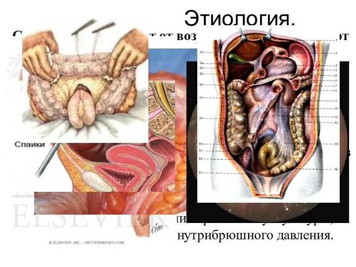 Этиология. Смена причин зависит от возраста (у детей лидируют аномалии развитии, у