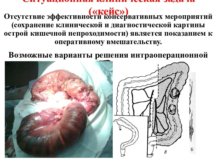 Ситуационная клиническая задача («кейс») Отсутствие эффективности консервативных мероприятий (сохранение клинической и диагностической