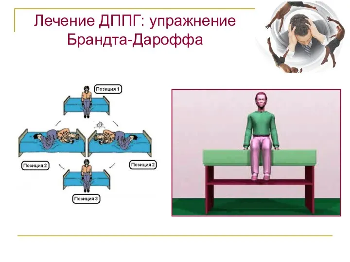 Лечение ДППГ: упражнение Брандта-Дароффа