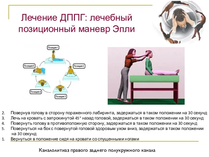 Лечение ДППГ: лечебный позиционный маневр Эпли Каналолитиаз правого заднего полукружного канала Сесть