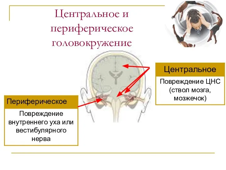 Центральное и периферическое головокружение