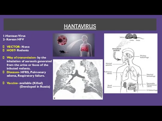 HANTAVIRUS 1-Hantaan Virus 2- Korean HFV VECTOR- None HOST- Rodents Way of