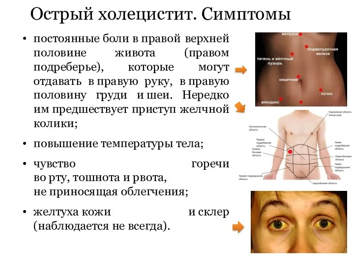 Острый холецистит. Симптомы постоянные боли в правой верхней половине живота (правом подреберье),