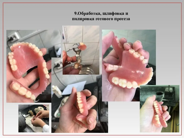 9.Обработка, шлифовка и полировка готового протеза