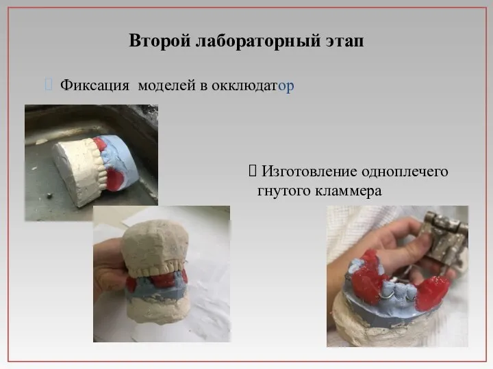 Второй лабораторный этап Фиксация моделей в окклюдатор Изготовление одноплечего гнутого кламмера