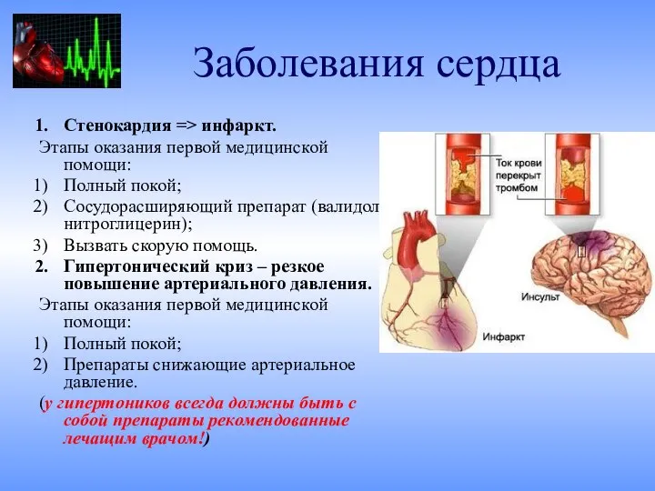 Заболевания сердца Стенокардия => инфаркт. Этапы оказания первой медицинской помощи: Полный покой;