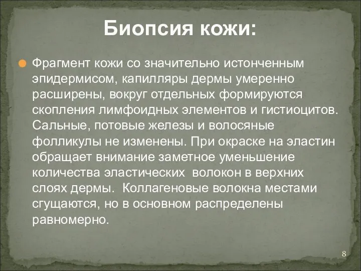 Биопсия кожи: Фрагмент кожи со значительно истонченным эпидермисом, капилляры дермы умеренно расширены,