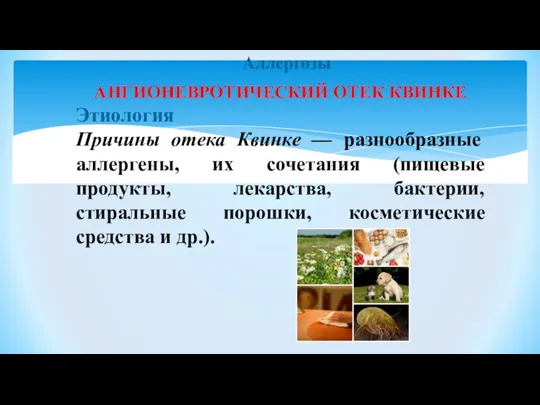 Аллергозы АНГИОНЕВРОТИЧЕСКИЙ ОТЕК КВИНКЕ Этиология Причины отека Квинке — разнообразные аллергены, их