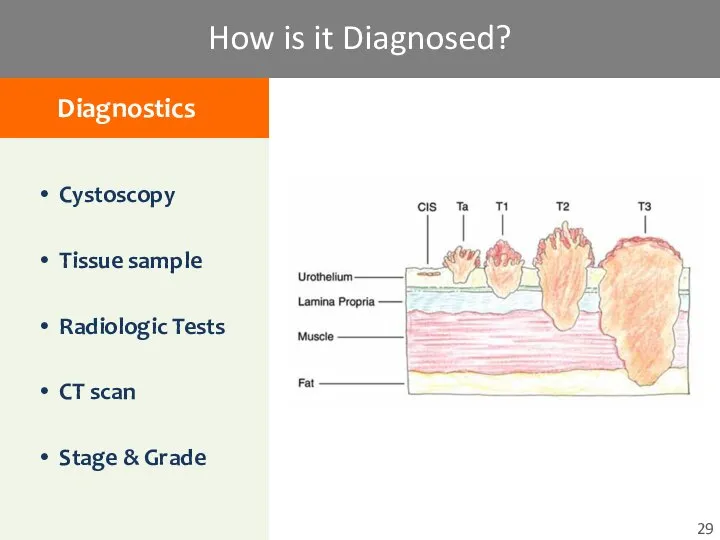Cystoscopy Tissue sample Radiologic Tests CT scan Stage & Grade How is it Diagnosed?