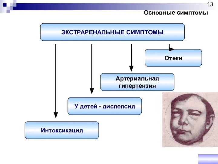 ЭКСТРАРЕНАЛЬНЫЕ СИМПТОМЫ Отеки Артериальная гипертензия У детей - диспепсия Интоксикация Основные симптомы 13