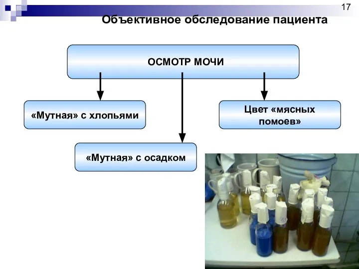 ОСМОТР МОЧИ «Мутная» с хлопьями Цвет «мясных помоев» «Мутная» с осадком Объективное обследование пациента 17