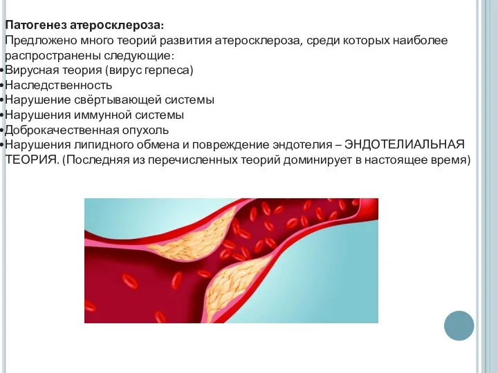 Патогенез атеросклероза: Предложено много теорий развития атеросклероза, среди которых наиболее распространены следующие: